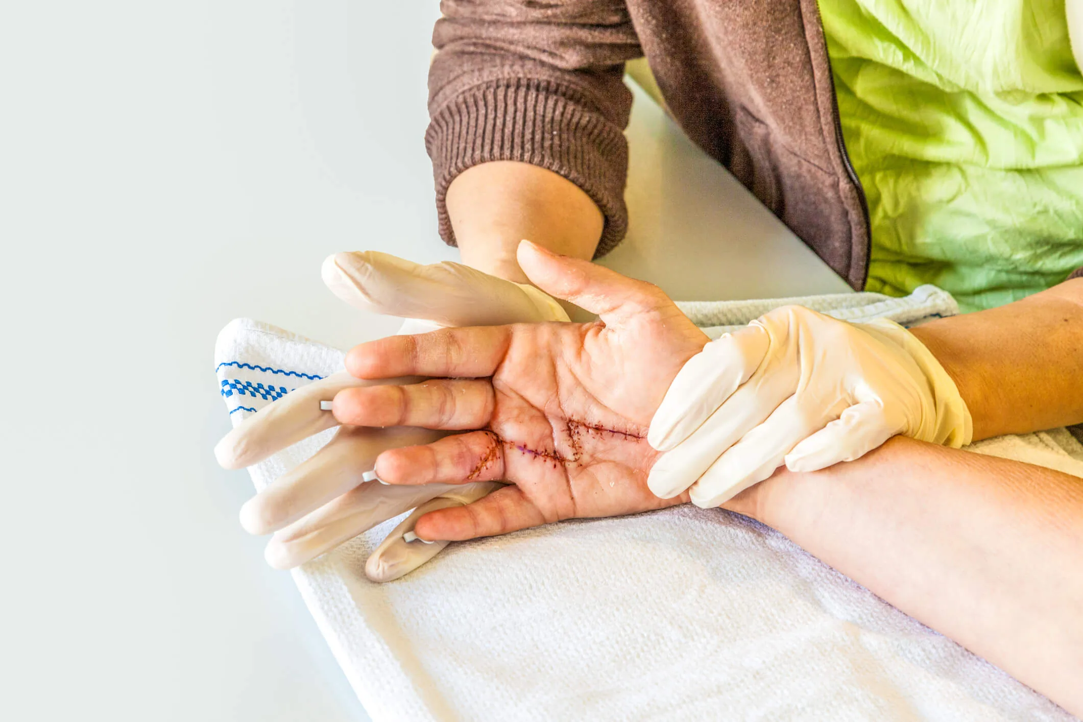 Beratung zur Ergotherapie in Stuttgart und Entscheidung über einen passenden Termin